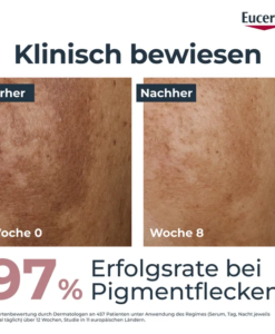 Tinh chất trị nám má tàn nhang Eucerin Anti-Pigment Dual Serum, 30ml
