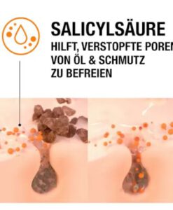 Sữa rửa mặt trị mụn Neutrogena Anti Pickel 2in1, 150ml