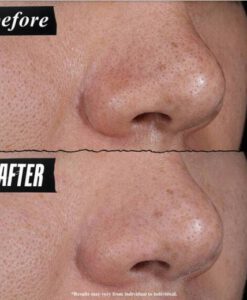 Mặt nạ đất sét Kiehl's Rare Earth Pore-Minimizing Clay Mask trị mụn, 14ml