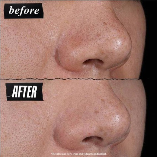 Mặt nạ đất sét Kiehl's Rare Earth Pore-Minimizing Clay Mask trị mụn, 14ml Mặt nạ đất sét Kiehl's Rare Earth Pore-Minimizing Clay Mask trị mụn, 14ml