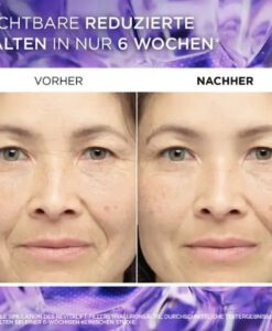 Serum Loreal Revitalift Filler chống lão hóa, giảm nhăn, 30ml