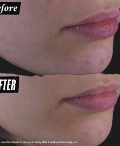 Nước cân bằng hoa cúc Kiehl's Calendula Herbal-Extract Toner, 250ml