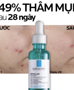 Tinh chất La Roche-Posay Effaclar Ultra Concentrated Serum trị mụn, giảm thâm, thu nhỏ lỗ chân lông, 30ml