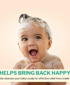 Dầu gội Dentinox Cradle Cap Treatment Shampoo trị cứt trâu, viêm da đầu cho trẻ sơ sinh, 125ml