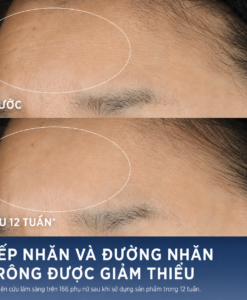 Serum Estee Lauder Advanced Night Repair phục hồi da ban đêm, 100ml